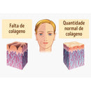 Colágeno Hidrolisado com Vitamina C + Zinco e Selênio - 60 Cápsulas Fórmula Concentrada